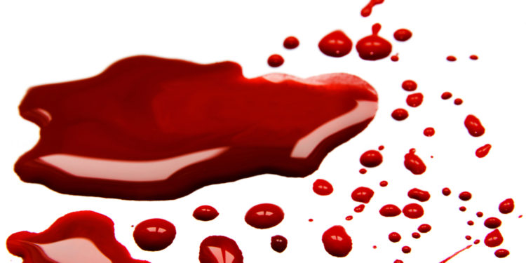 Bitcoin Carnage Continues As BTC Disintegrates To $34K