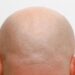 All Hype? BALD Meme Coin’s Volume Shaved By 96%