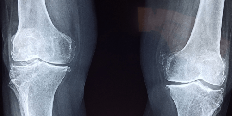 Shibarium Network Lull – How It Affects The Future Of BONE