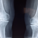 Shibarium Network Lull – How It Affects The Future Of BONE